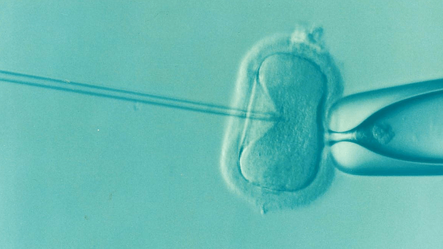 IVF in the laboratory