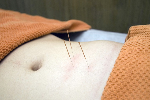 Woman in acupuncture procedure