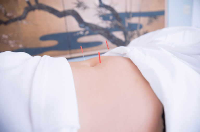 fertility acupuncture procedures in Orange County